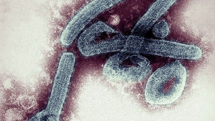 Marburg Virus Outbreak Kills Five People In Tanzania » Uzalendo News
