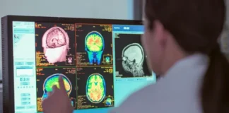 Brain Development Study Identifies Four Pivotal Ages, Extends Adolescence into 30s