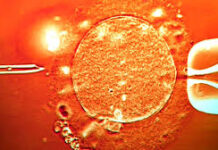 Fertility Clinic Used Sperm from Donor with Cancer Gene, Fathering Nearly 200 Children