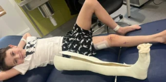 Boy first in UK to have pioneering leg-lengthening surgery